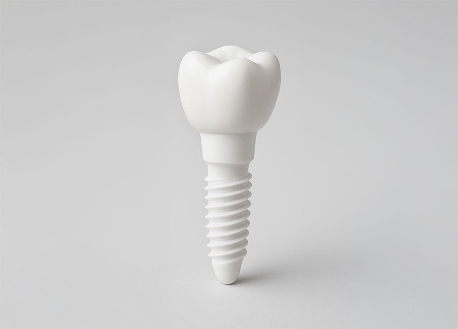 ceramic-implant